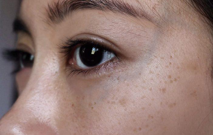 Flek Hitam di Wajah Pengaruh Lingkungan atau Hormon Halodoc