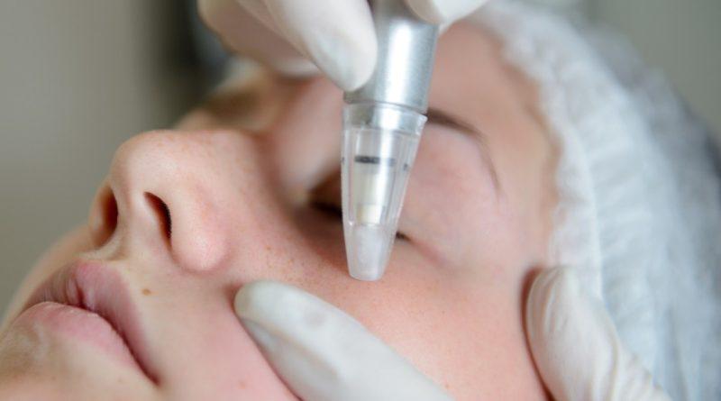 What is microdermabrasion