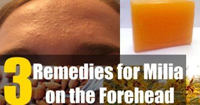 3 Remedies for Milia on the Forehead