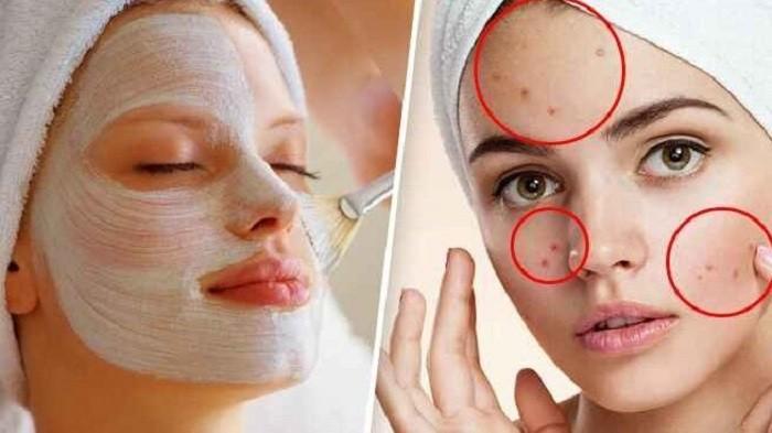 9 Cara Alami Hilangkan Flek Hitam di Wajah Tanpa Perlu Skincare Mahal master 151965317 1